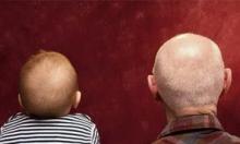 男子脱发90%和基因有关 外孙遗传外公发型