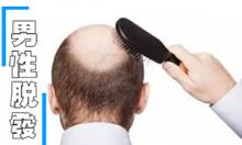 别不把脱发当回事 男性治疗脱发的八大误区