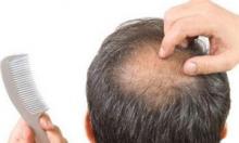 40岁男人秃顶怎么办 治疗秃顶的五大方法