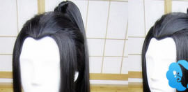 头发种植手术让M型发际线和美人尖之间的区别变得可逆