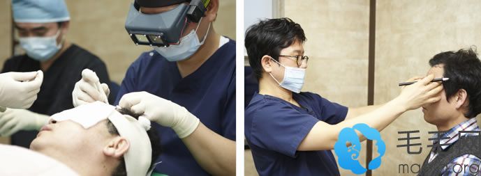 韩国黄盛柱毛发移植中心手术过程