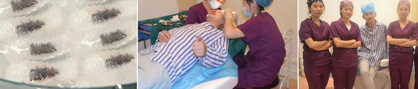 维多利来植发中心为张鑫提取行囊及手术全过程