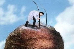 移植毛发会不会很痛?植发医生总结术后护理细节及保养方法