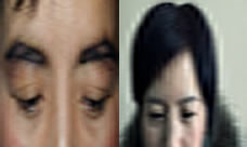 西安新锐眉毛种植案例及恢复效果 开运植眉新年开好运