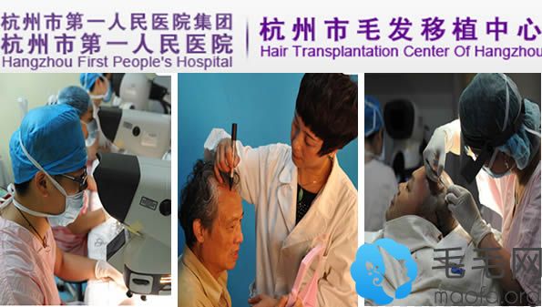 杭州市人民医院毛发移植中心植发过程