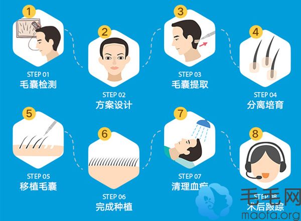 据说后枕部能提取5000毛囊单位但我后脑勺头发少怎么植发呢