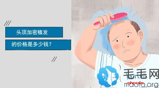 2100元种300毛囊的头顶加密植发费用在深圳植发医院中算便宜