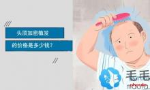 2100元种300毛囊的头顶加密植发费用在深圳植发医院中算便宜