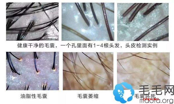 头发微量元素检测,内分泌检测,皮肤镜,头皮病理切片