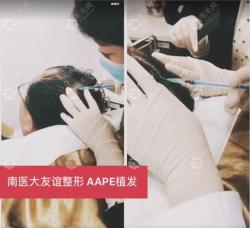 如何让头发再生的方法:南京友谊AAPE头发细胞再生疗法
