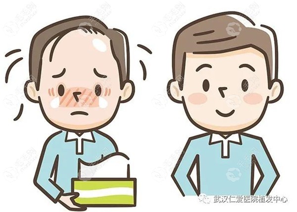 郑州排行前十名的发际线植发医院名单让你告别发际线后移