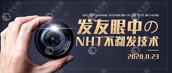 记录：在北京碧莲盛做NHT技术植发际线后的真实体验和评价