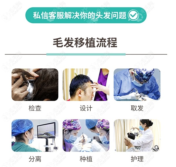 武汉新生植发医院的种植头发流程