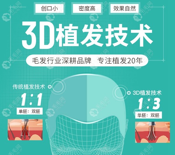 南京新生3d植发一般费用是多少?该技术是什么时候开始的?