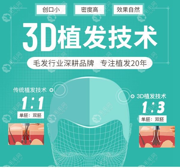 南京新生的nocut植发技术和3d植发的区别是什么？