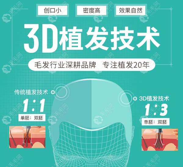 武汉新生植发医院3D植发技术优势