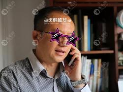 45岁在南宁贞韩做前额头顶加密3000单位后的三个月效果图