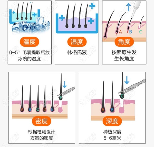 华美植发的几大优势点