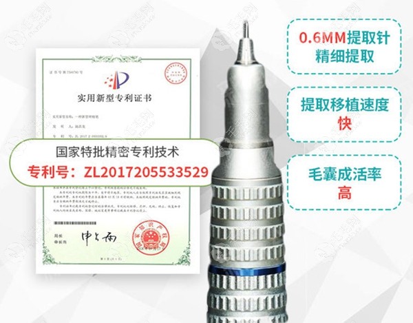广州荔医专业的植发技术