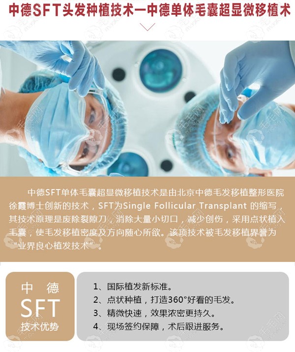 北京中德SFT植发技术优势