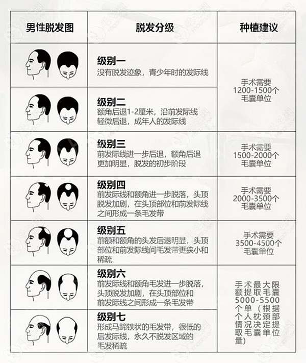 恒美可治疗1-7级脱发