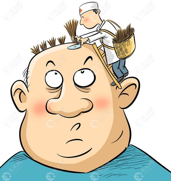 科普斑秃分为哪几种类型以及展示不同类型斑秃的图片