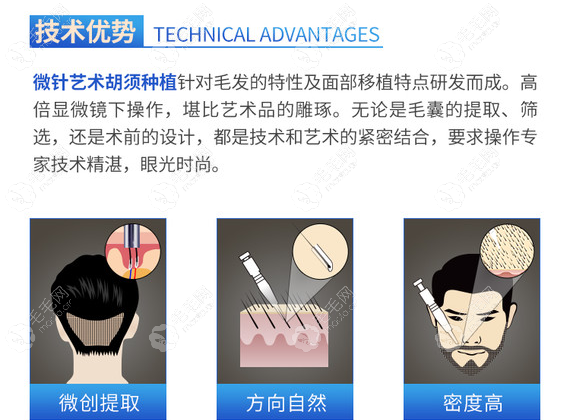 胡须种植手术方法