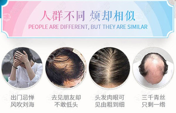 头发加密为什么比植发贵，两者区别和效果相差距蛮大