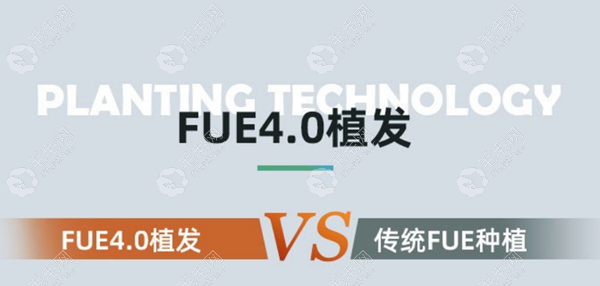 FUE4.0技术对比FUE技术