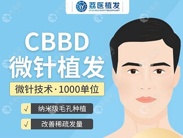 广州荔湾人民医院CBBD技术