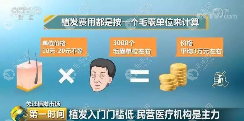 郑州植发手术一般多少钱