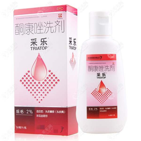 脂溢性脱发可以用采乐酮康唑洗剂吗?其用法及价格如下