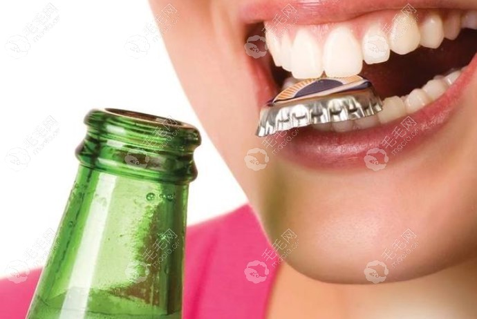 经常用牙齿起瓶盖种植牙寿命不会长