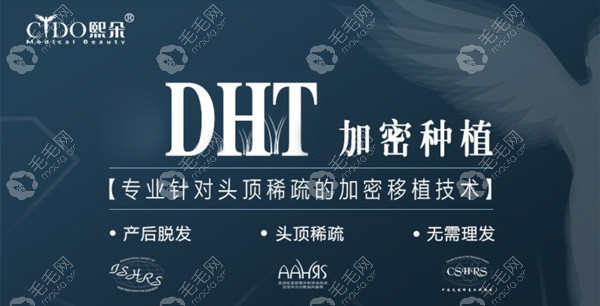 熙朵DHT植发加密技术的价格贵吗,要看它对原生发有无损害
