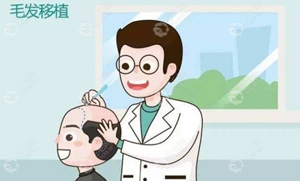 大麦微针植发的王悦医生专注于毛发移植