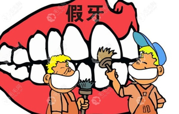 补牙方式有三种活动义齿
