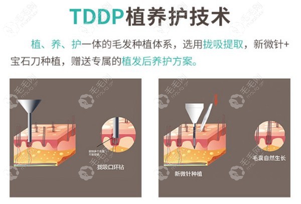 TDDP植养护一体技术