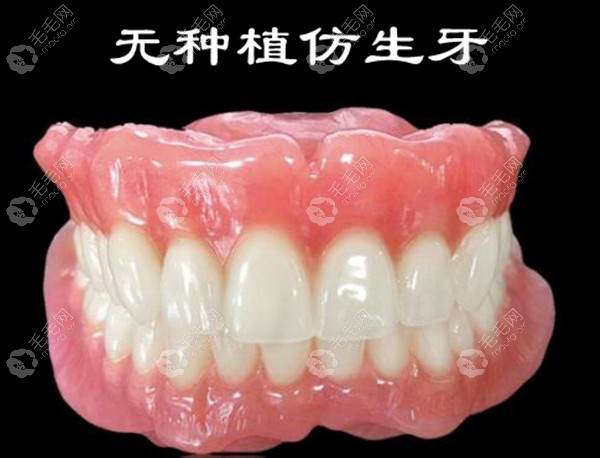 日式无种植仿生牙是什么原理?老人用仿生牙和种植牙哪个好