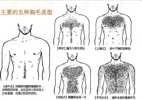 男性胸毛种植形状和方向