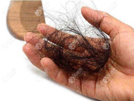 要想知道毛囊有没有坏死还得参考以下几种方法:1,把脱落的头发进行