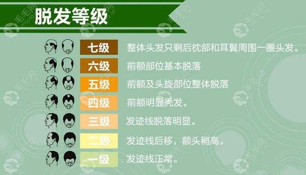 上海静安区植发医院名单