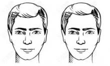 男士额头窄怎样调整发际线之额头窄脱发际线好看吗？