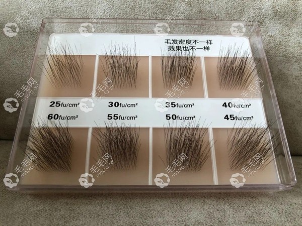 头顶见白的时候,我的头发密度是什么样的?