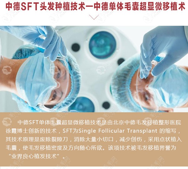 北京中德SFT超微针植发技术介绍