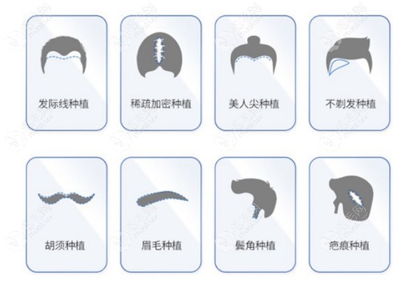 植发权威医院排名(植发技术最好的植发医院)