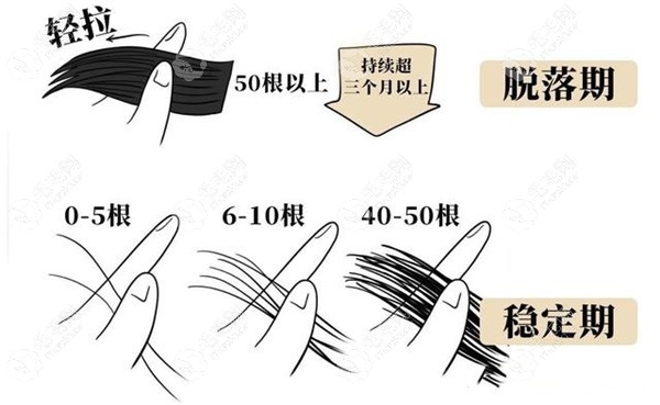 头发拉扯脱发试验