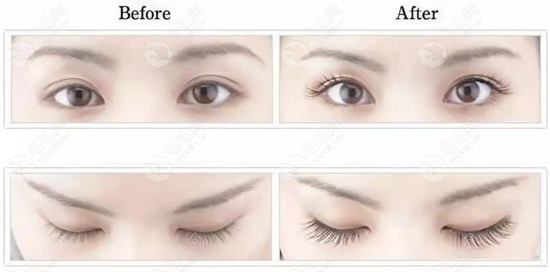 睫毛种植前后对比图