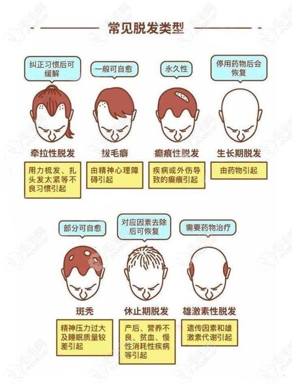 
分散性植发的危害