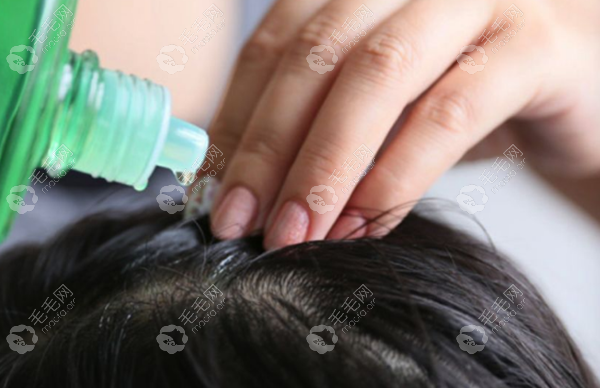 JG生发液的具体使用方法