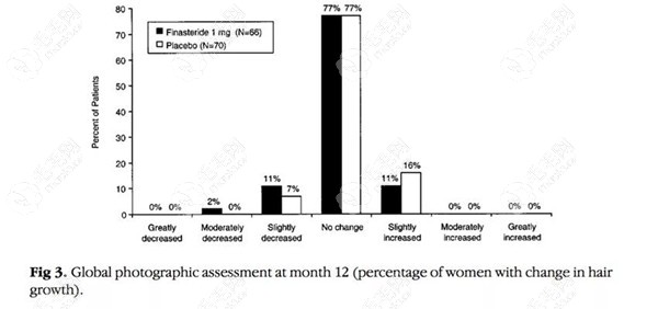 女性服用非那雄胺与安慰剂的对比